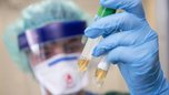 74 новых случая заболевания COVID-19 зарегистрировано в Приморье