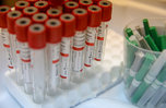 Число новых случаев коронавируса в Приморье выросло впервые за полторы недели
